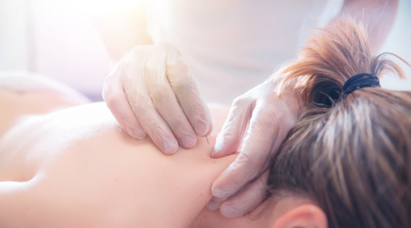 Acupuncture Treatment