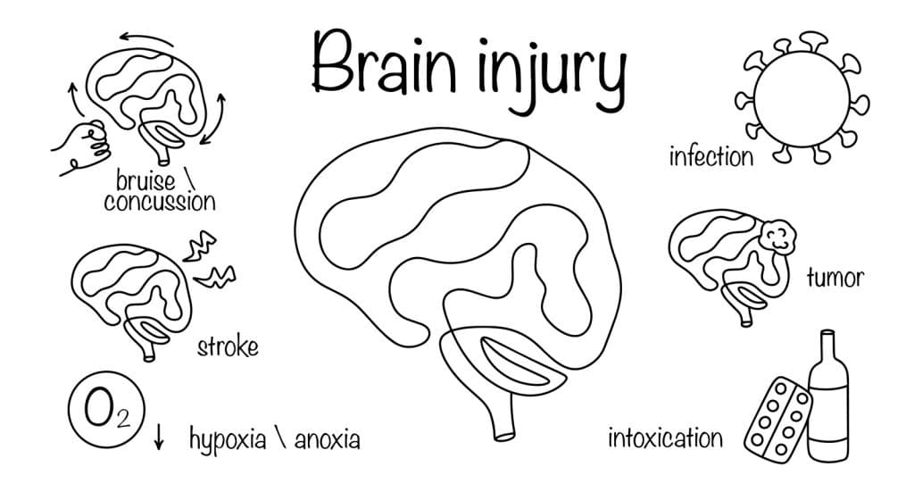 How Long After a Concussion Can You Drink? Doctor-Recommended Timeline