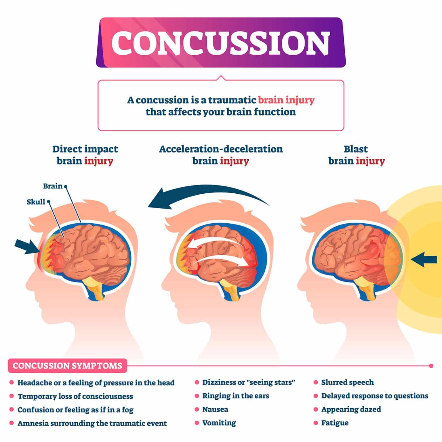 What Do U Do If U Have A Minor Concussion